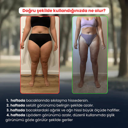 3'Lü Etki Taytı Lipödem, Selülit, Varis